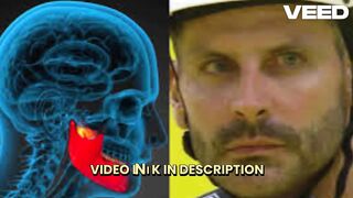 [Original] enri castelli convulsão henri castelli agredido 2020 henri casteli