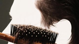 Hair Loss in Men  Women Real Reasons