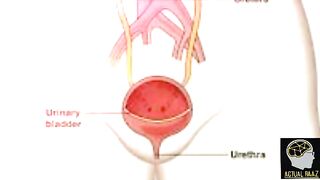 سوزاک پیشاب کی نالی میں انفیکشن، پیشاب میں شدید جلن کا گھریلو علاج