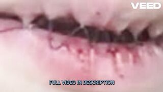 Bestgore