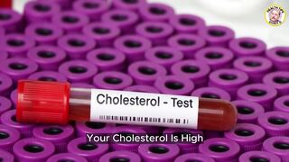 Cholesterol Pattern A vs Pattern B Explained Simply