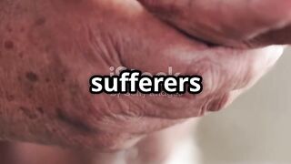 Fight Arthritis in Fingers_ Top Prevention
