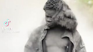 Viral