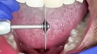 Why is the dentist grinding your teeth