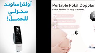 Portable Sonoyou Ultrasound Probe for Pregnancy – Real-Time Mobile Imaging
