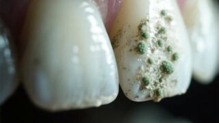 Dangers of Bad Breath