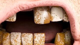 অদ্ভূৎ দাঁত ???? শুনলে শিউরে উঠবেন!