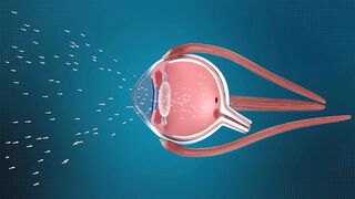 Working Of Human Eyes - Structure And Function Of Human Eyes (Urdu-Hindi)