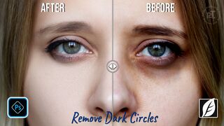 Dark Circles Disappear With This Photoshop Technique