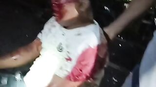 Terjadi kecelakaan harap hati hati