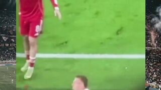 Bagaimana bisa jempol pemain hampir putus di pertandingan Liga Champions?