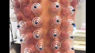 manfaat bekam IDNGOAL