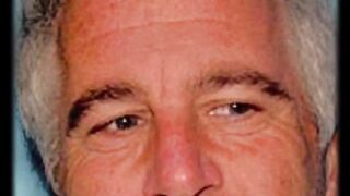 Palm Beach Pete REVEALED: The Epstein Surgery Theory ????