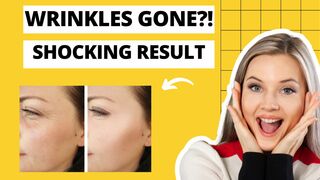 DermaEssential Legit or Scam? ⚠️ Shocking Truth 2026 Review