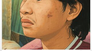 fajar sadboy kecelakaan motor cukup parah,kuku hingga tulang bergeser