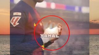 Pernah sadar kenapa Yamal selalu pakai perban di tangannya ?