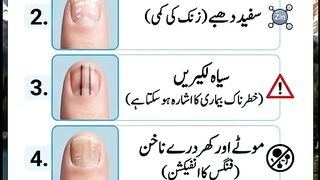 Nail se jism ki bimariyan check kri