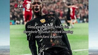 Kaget banget liat bercak hitam di lengan Dembele pas lawan Bayern! ????