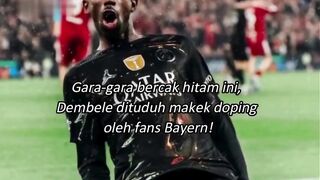 ans Bayern tuduh Dembele pakai doping gara-gara bercak hitam di tangannya! ????????