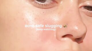 Skin Slugging Just Got a Major Upgrade! ✨????‍♀️????