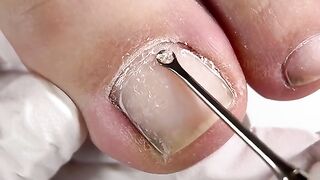 any transformation pleases the eye! I take out the tamponade under my nails,