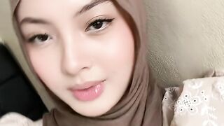 Contact eye