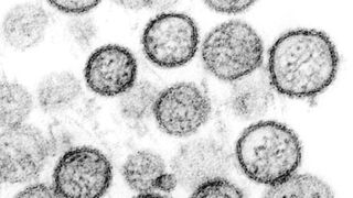 Orthohantavirus