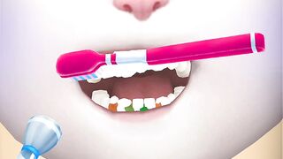 My Talking tom Angela2 Teeth cleaning