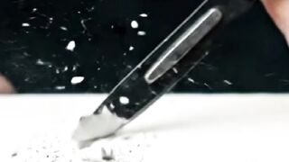 Wait For The Sharp Scalpel Slice... ????????