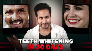 Celebrity TEETH WHITENING Secrets Revealed _ Whiten 20 Shades in 1