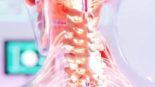 señales tempranas de osteoartritis cervical