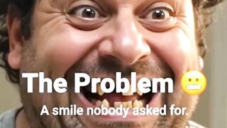 Missing Teeth Guy Hired To Smile