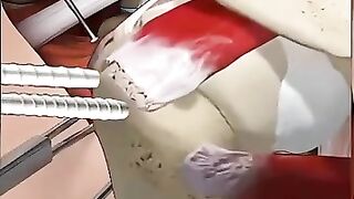 Rotator_Cuff_Repair_Surgery__Arthroscopic_Tendon_Reattachment_Animation