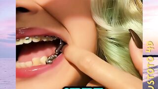 Menyelaraskan Gigi dan Rahang Menggunakan Herbst Applience versi PLUSTOTO4D