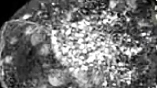 Scientists Link Footprints Of Death To Viral Spread And Immunity