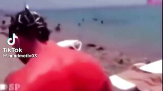 Sunburn