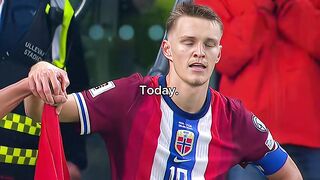 Norwey vs brazill ☠️☠️☠️