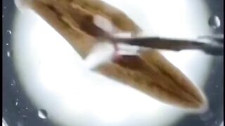 Cacing datar planarian memiliki salah satu kemampuan luar biasa