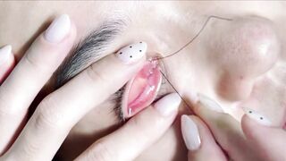 #Eye #Relaxation #Therapy