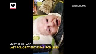 Martha Lillard, the last US polio patient using an iron lung, dies at 78