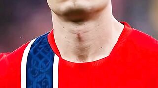 gara-gara ga Oper Haaland, Sørloth kena hujat di Instagram..