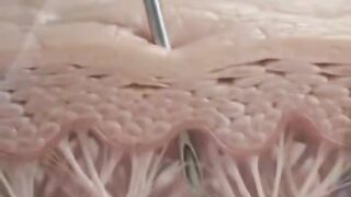 An injection process inside your body  what happens after  a doctor gives you an injection?🧐👇🏾