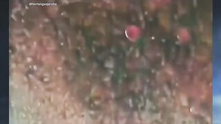 1,5 Juta Balon yang Melumpuhkan Sebuah Kota ‼️