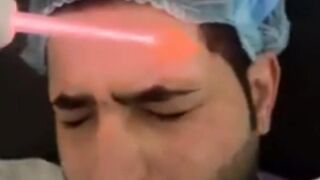 amazing face lasering |  new face Laser technology #shorts