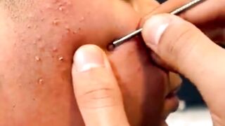 Face cleaning