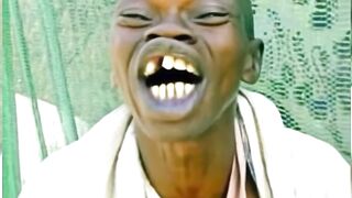 The Weirdest Face on the Internet?! Everyone's Reactions Are Unbelievable 😂🔥#shorts #viral #funny 3
