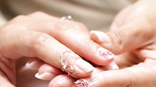 Transform Damaged Nails: Advanced Repair & Restoration Inspo #NailCare #NailRepair