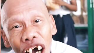 Try Not to Laugh! The Funniest Face on the Internet – 99% of People Lose This Challenge!” #shorts