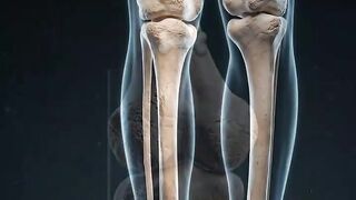 The Tibia Explained | The Strongest Weight-Bearing Bone in Your Lower Leg