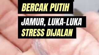Jamur, Luka, Bercak, Borok pada ikan lele sembuh total